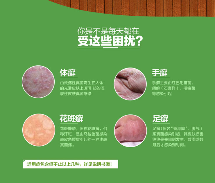 盐酸特比萘芬喷雾剂价格