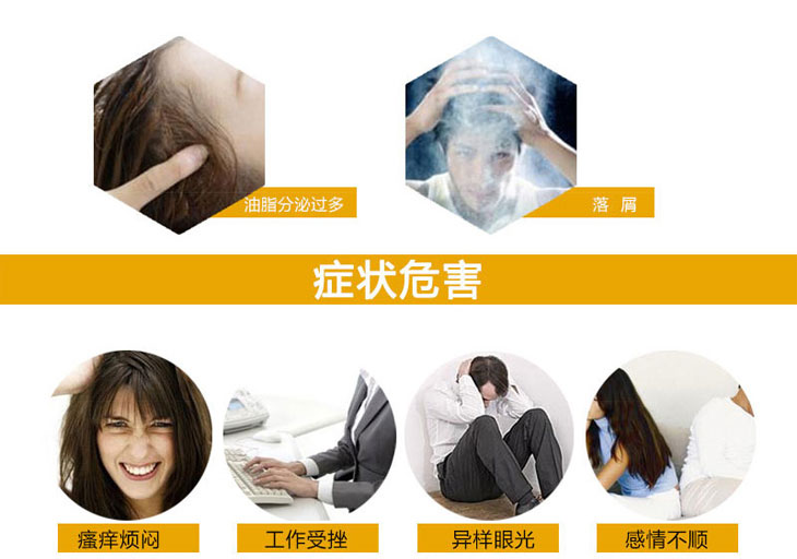 除脂生发片价格