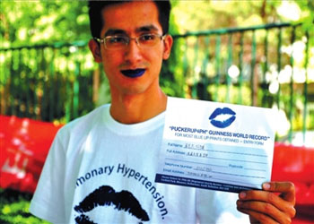 志愿者涂上蓝色嘴唇，意在让罕见病患者不再孤单、绝望