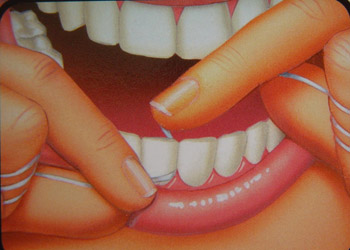 经常塞牙危害多 牙线超牙签成清洁牙缝"神器"