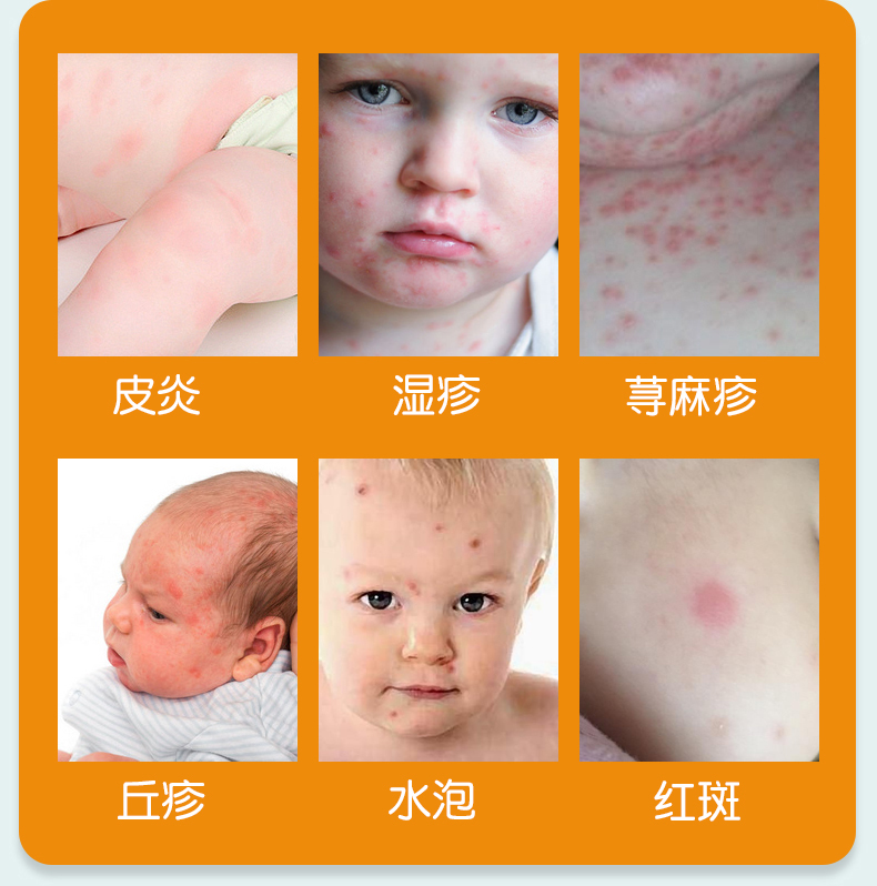 /uploads/image/2021/03/11/微贝3.jpg 微贝3.jpg